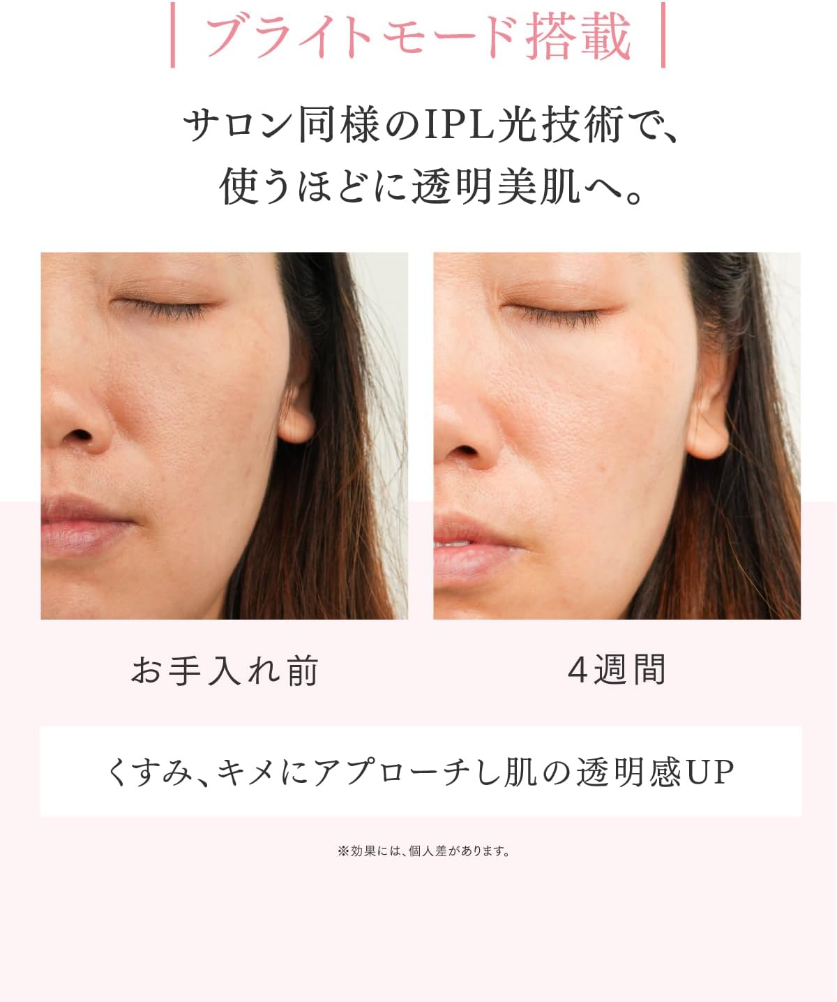 MYTREX 光美容器MiRAY AiRのレンタル