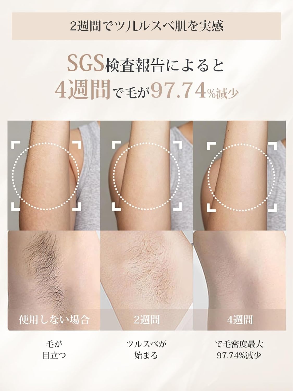 Yete アイスクリーム脱毛器のレンタル