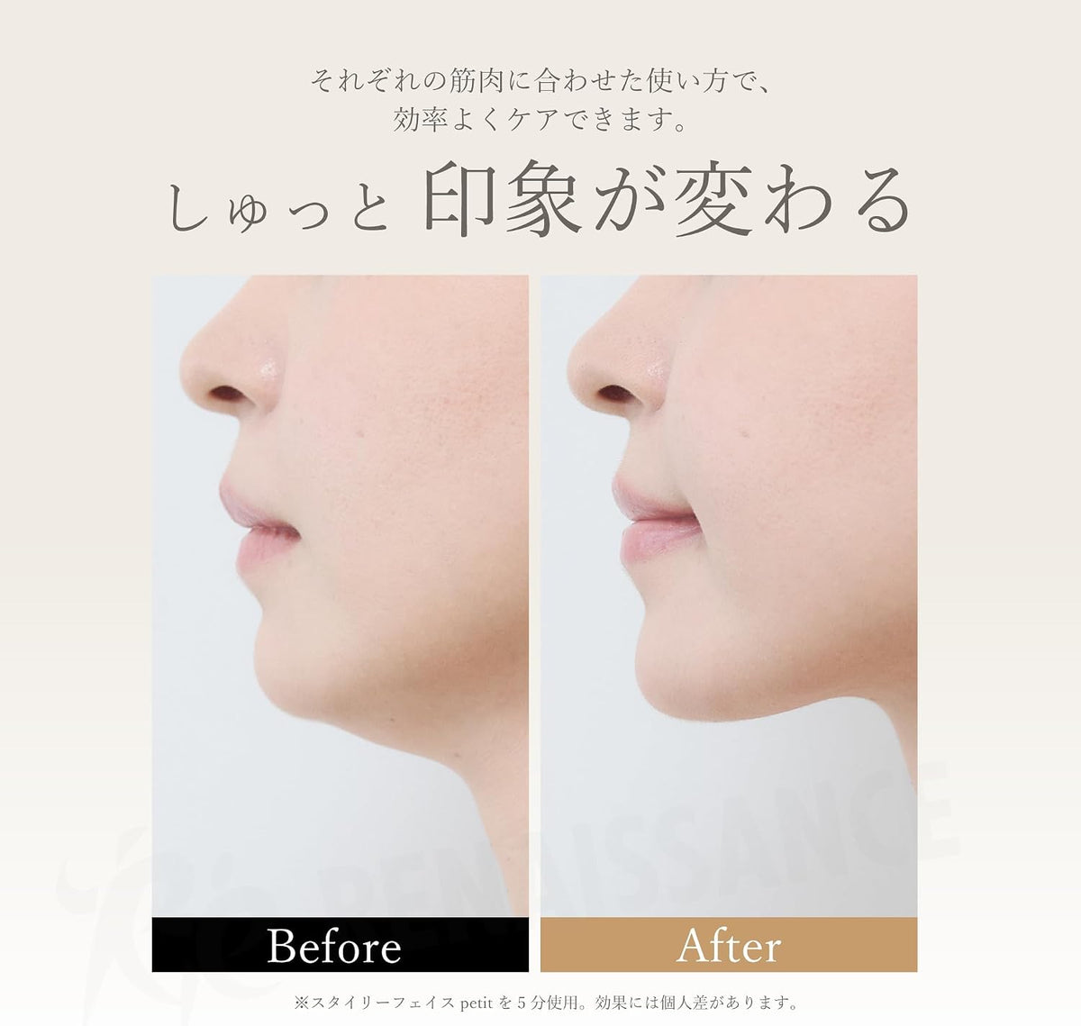 ルネサンス RE 美顔器 petitのレンタル