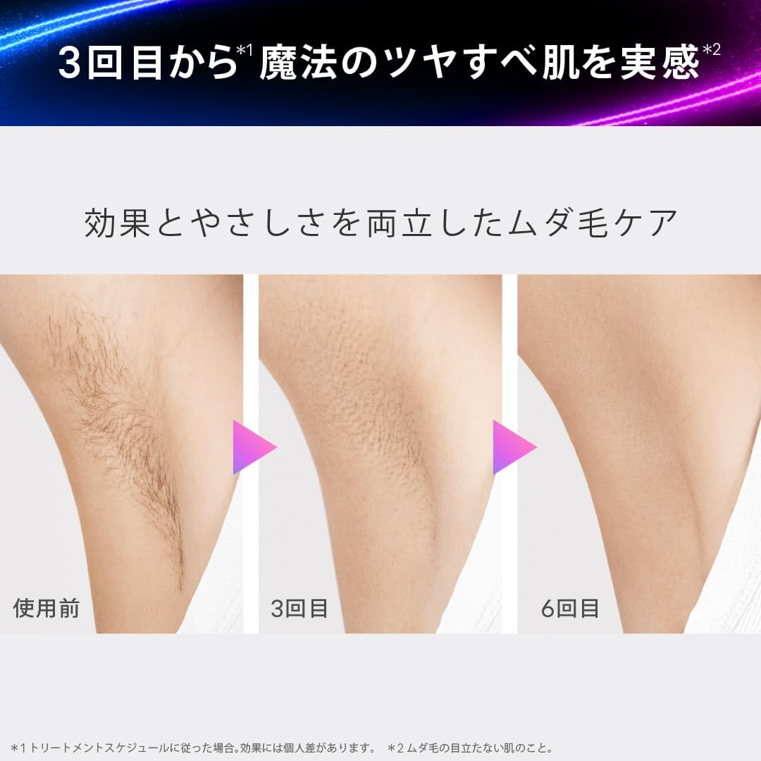 ブラウン 光脱毛器 シルクエキスパートミニのレンタル
