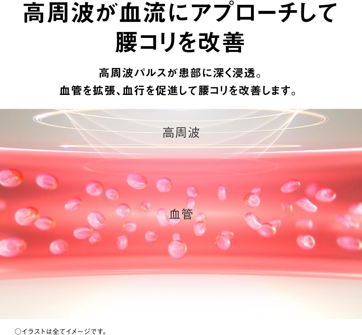 パナソニック 高周波治療器 コリコランワイド3D（腰専用）のレンタル