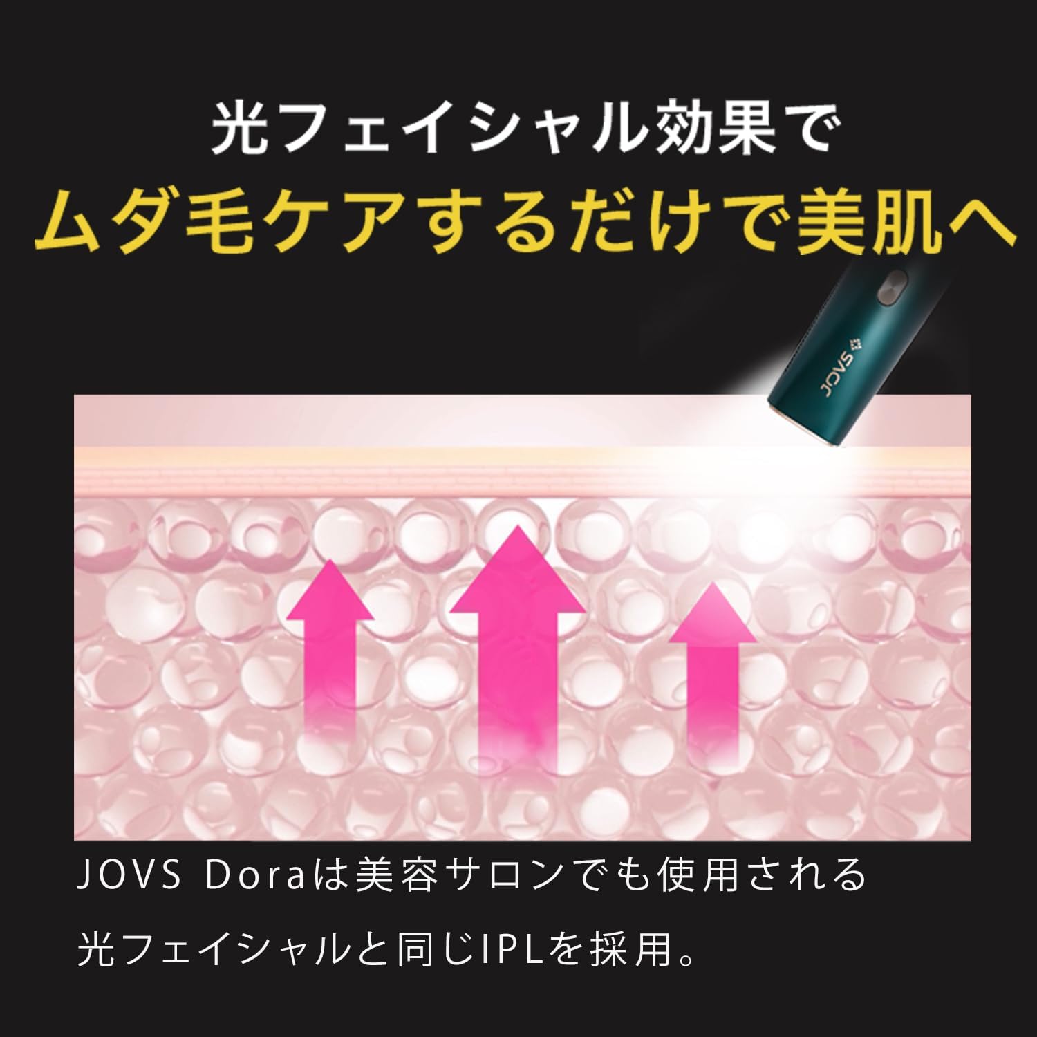 JOVS 家庭用脱毛器 Doraのレンタル