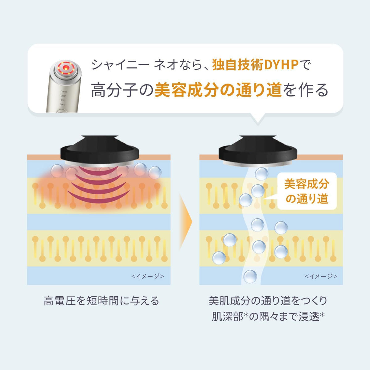 ヤーマン 美顔器 フォトプラスシャイニーネオのレンタル