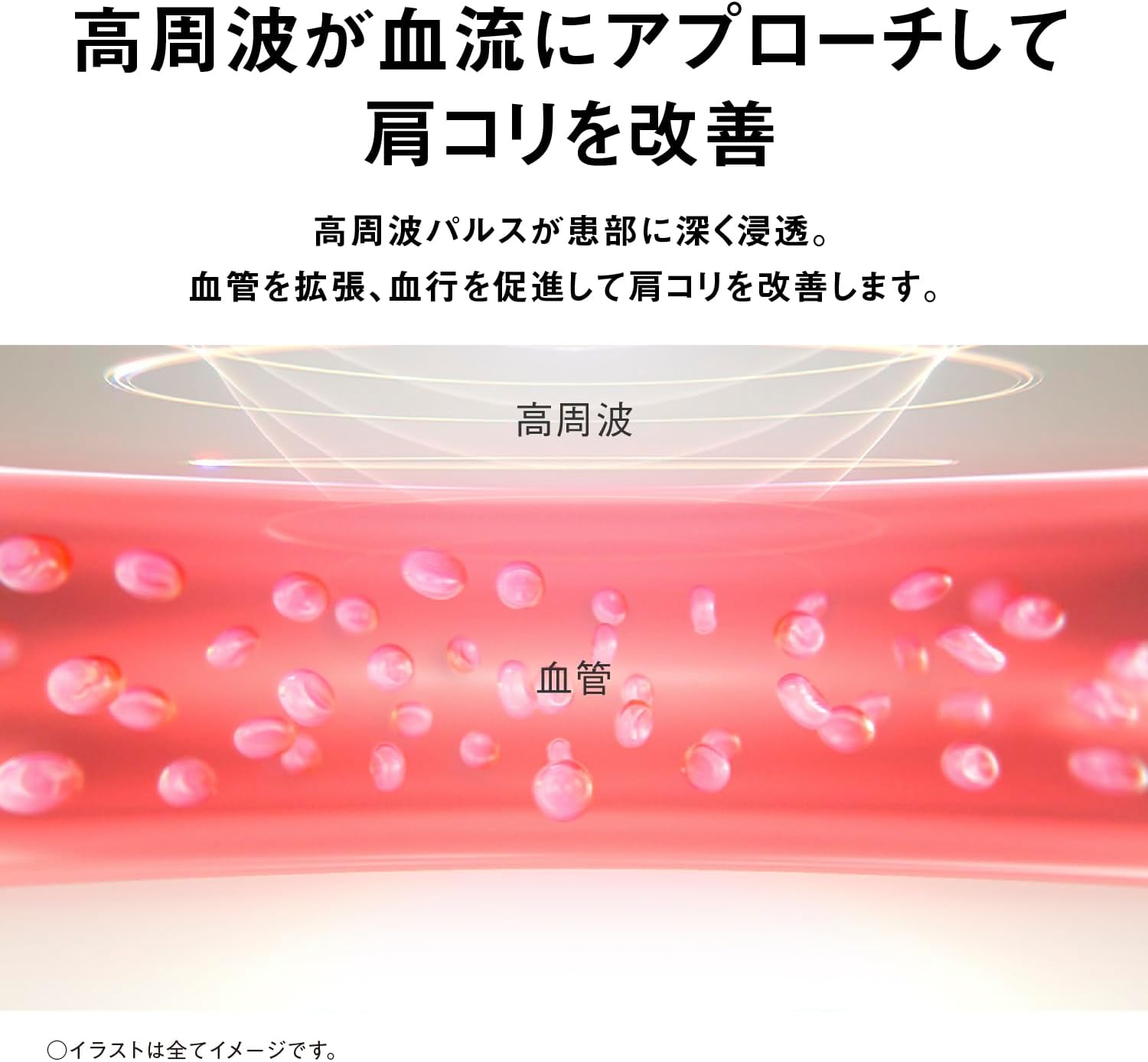 パナソニック 高周波治療器 コリコランワイド3D EW-RA560のレンタル