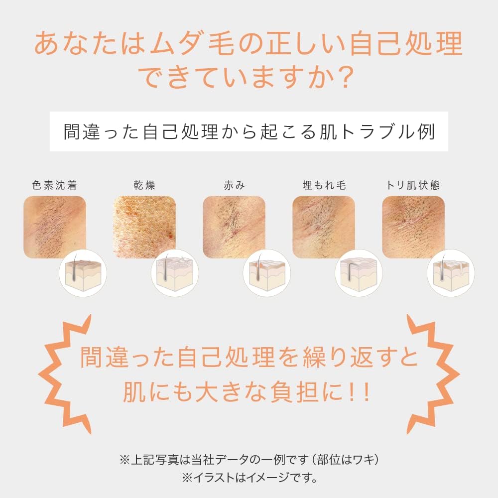 TBC 光美容器 ヒカリビューティ 4 PROのレンタル