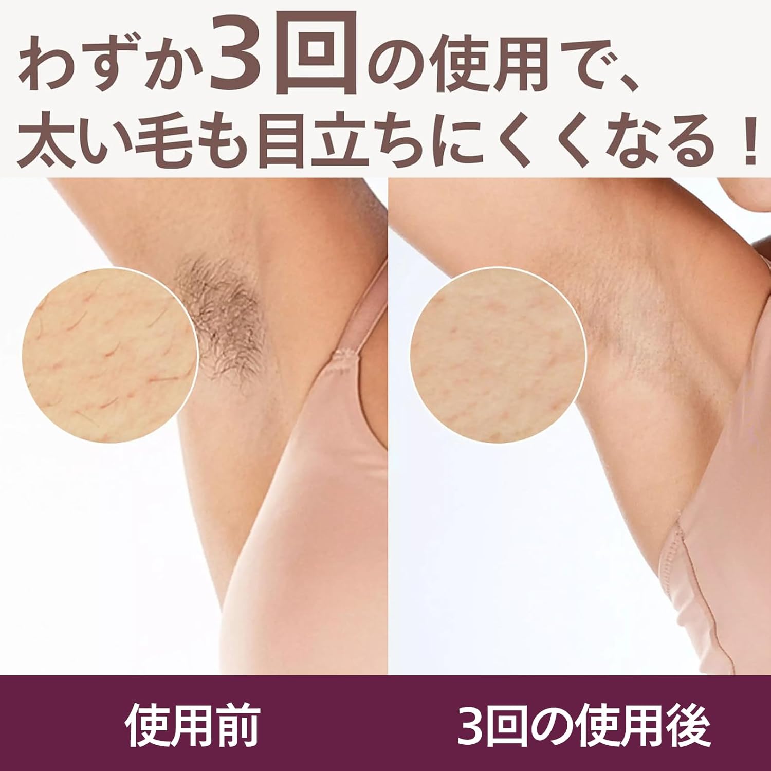 フィリップス 光美容器 ルメア 8000のレンタル