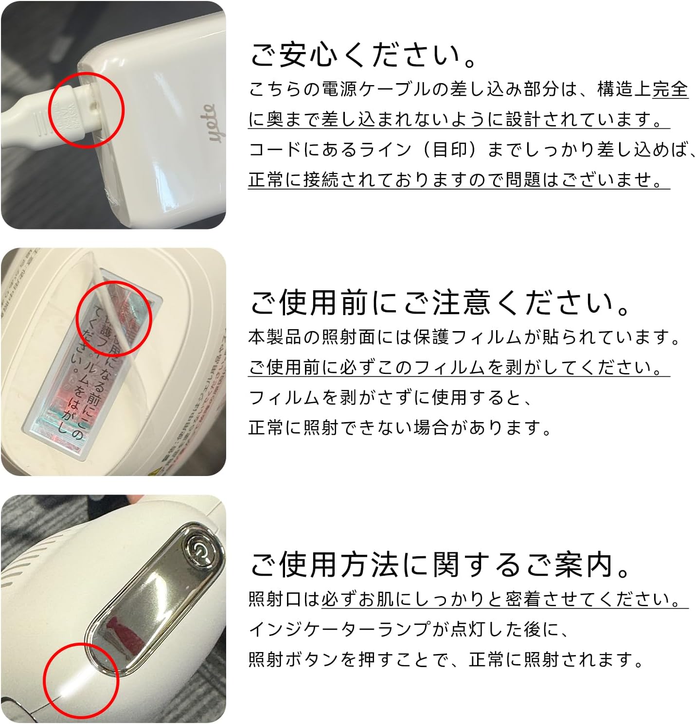 Yete IPL光脱毛器のレンタル