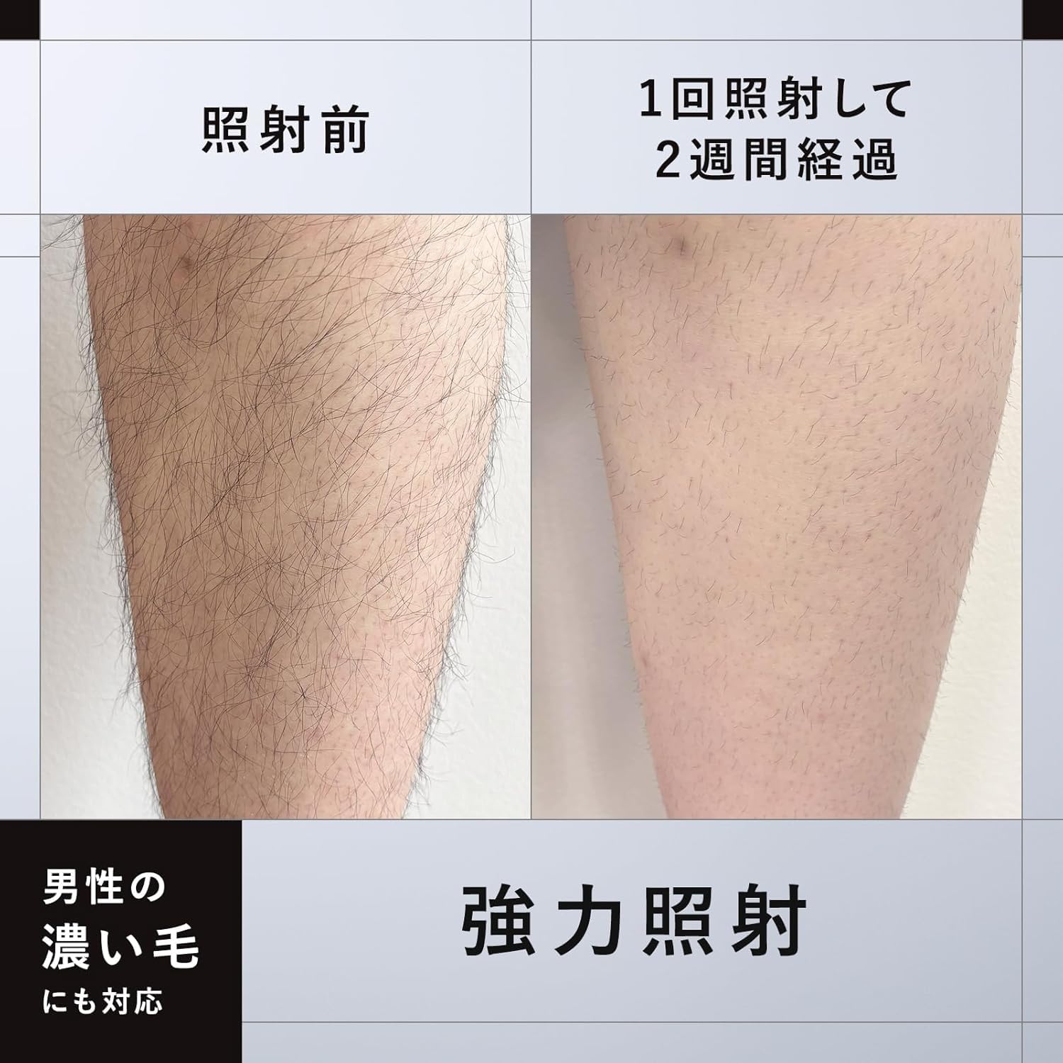 ium 光美容器 スピードショットのレンタル