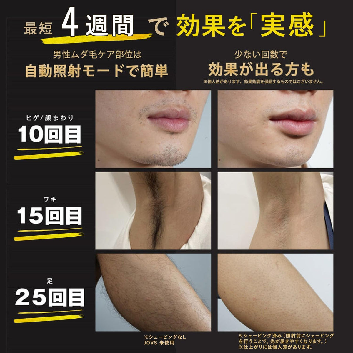 JOVS 家庭用脱毛器 Doraのレンタル