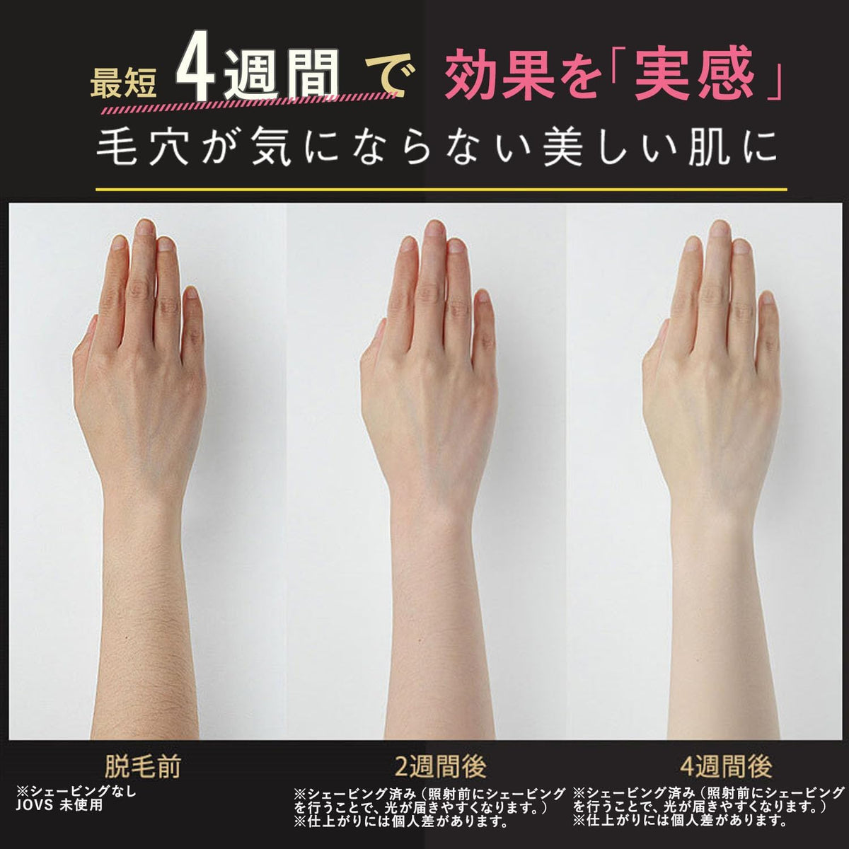 JOVS 家庭用脱毛器 Doraのレンタル