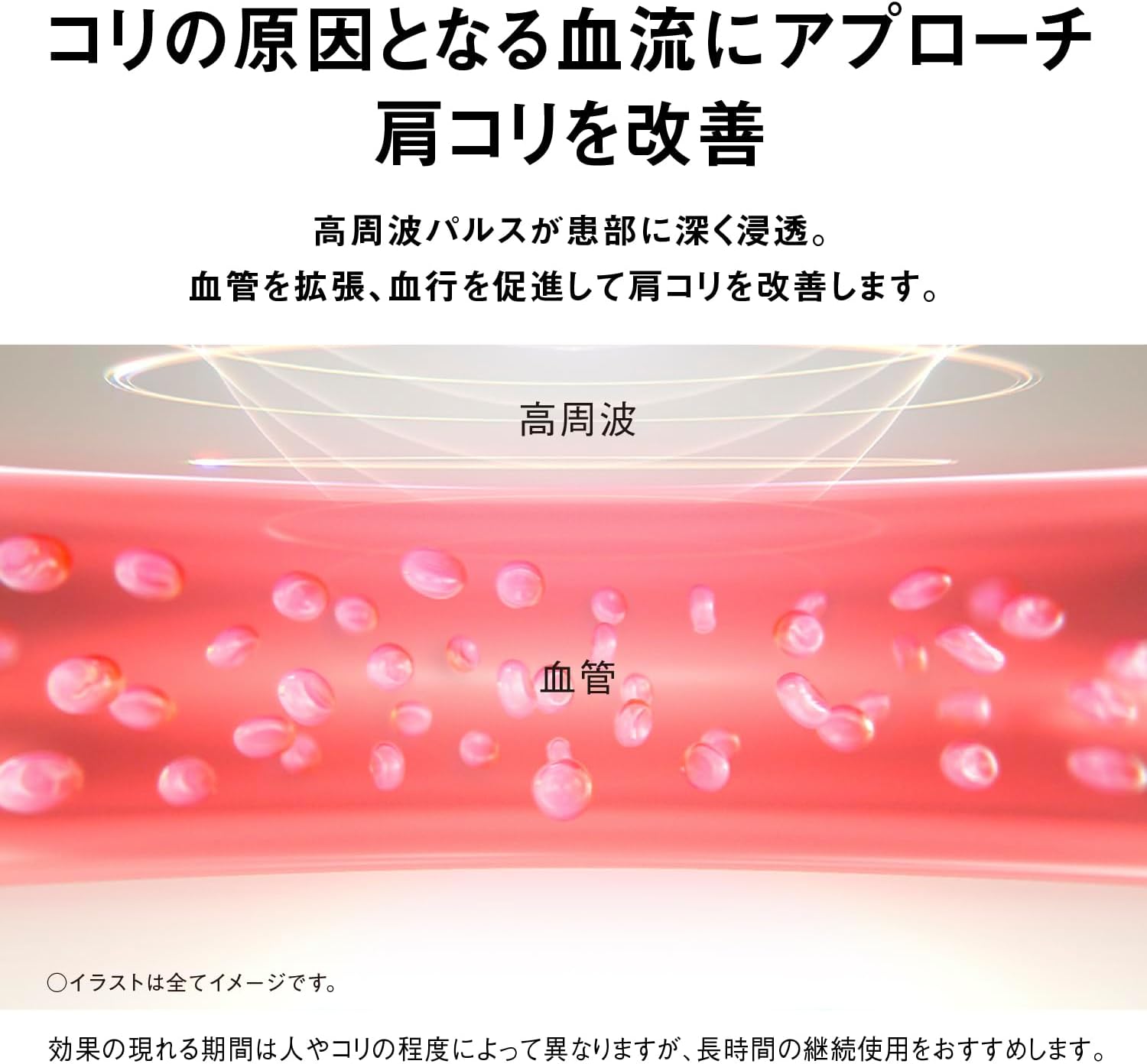 パナソニック 高周波治療器 コリコランループ EW-RA520のレンタル
