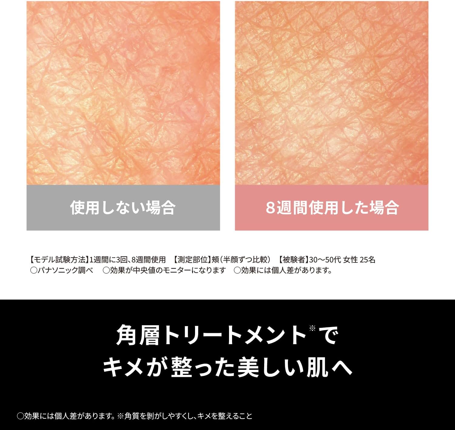 パナソニックフォト ブライトショット 光美顔器のレンタル